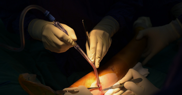 Vụ cháy chung cư mini ở Khương Hạ: Người phụ nữ nhảy từ tầng 9 xuống giờ ra sao?