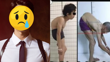 Nam diễn viên nổi tiếng mắc bệnh hiếm gặp, chỉ 1% dân số nước này mắc phải