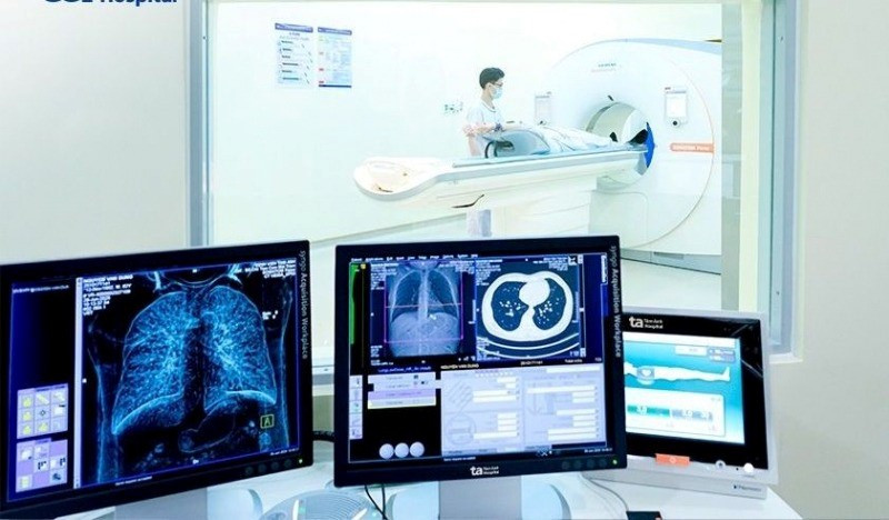 Bác sĩ Bệnh viện K tiết lộ những dấu hiệu 'ngầm' của ung thư phổi - ảnh 2