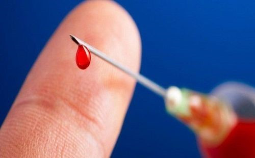 Virus ‘sát thủ’ lây nhanh gấp 100 lần HIV, Việt Nam thuộc nhóm có tỷ lệ nhiễm cao nhất khu vực - ảnh 2