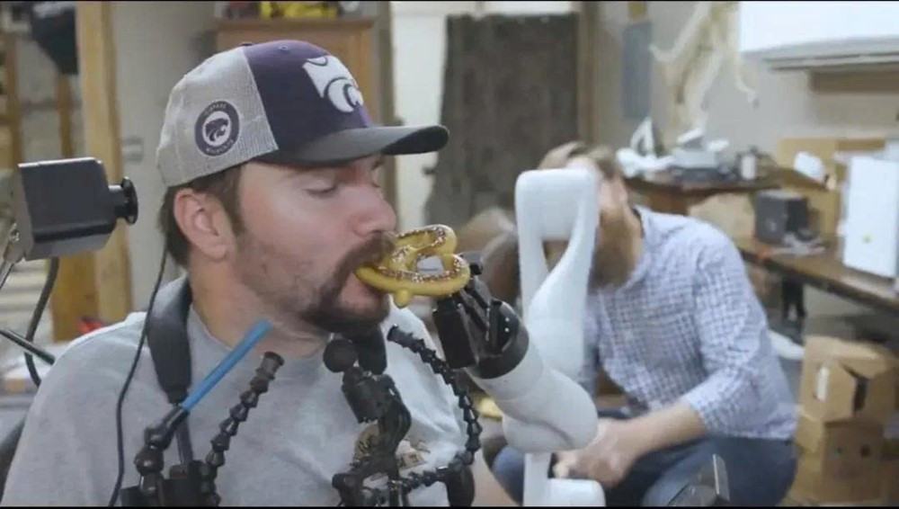 Công ty của Elon Musk cấy chip vào não người chỉ trong 1,5 giây, hơn 10.000 người đang xếp hàng - ảnh 2