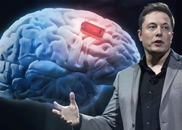 Công ty của Elon Musk cấy chip vào não người chỉ trong 1,5 giây, hơn 10.000 người đang xếp hàng