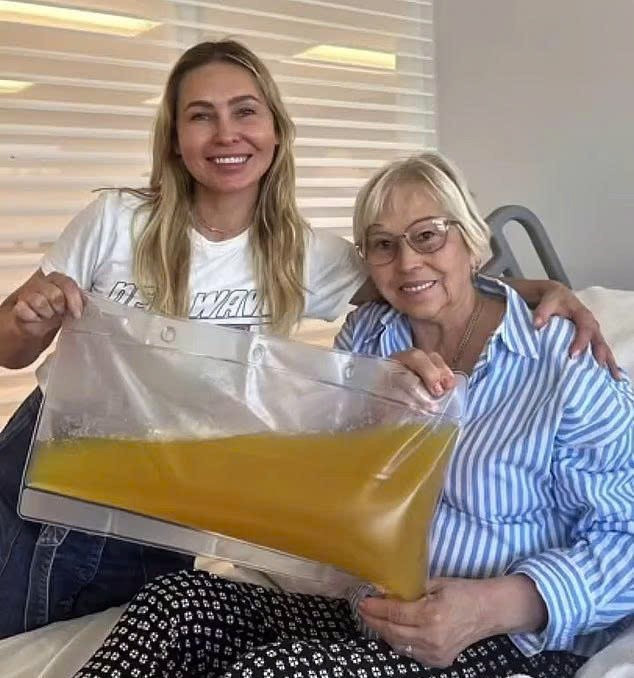 Giới siêu giàu rộ mốt ‘lọc máu’ để kéo dài tuổi thọ, giá 10.000 USD/lần - ảnh 3