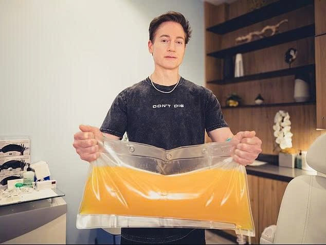 Giới siêu giàu rộ mốt ‘lọc máu’ để kéo dài tuổi thọ, giá 10.000 USD/lần - ảnh 1