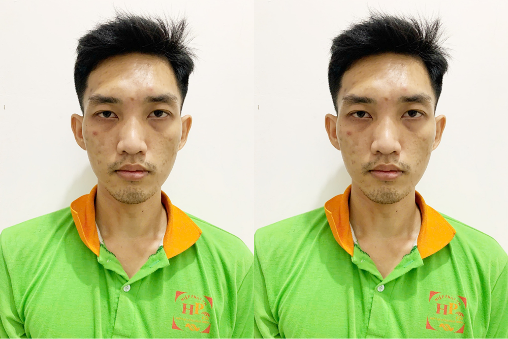 Nguyễn Quốc Thịnh, 30 tuổi bị truy nã vì trộm 17kg khô mực ra đầu thú - ảnh 1