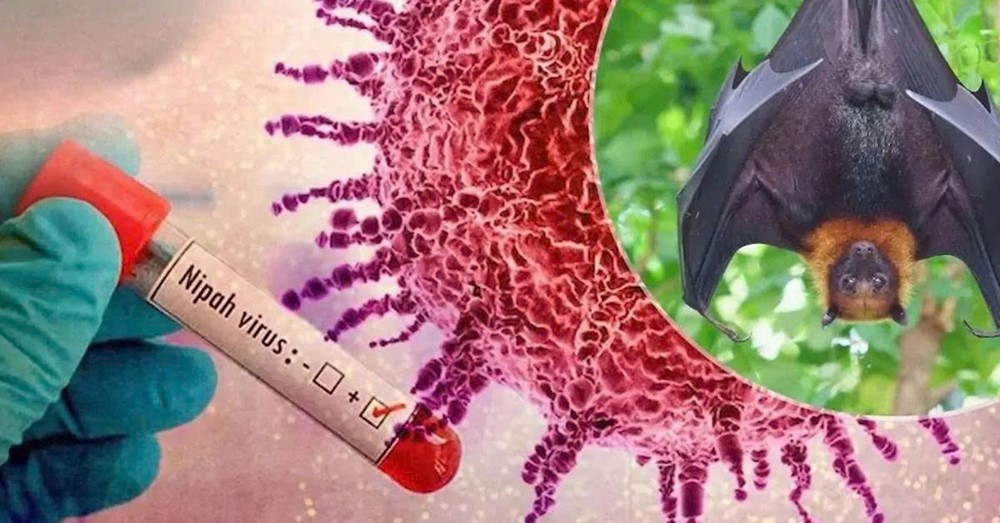 5 lý do khiến WHO xếp Nipah vào nhóm mầm bệnh nguy hiểm nhất thế giới - ảnh 1