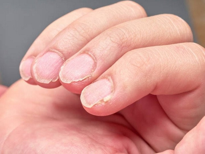 5 dấu hiệu cảnh báo cơ thể thiếu sắt, cần bổ sung ngay - ảnh 1