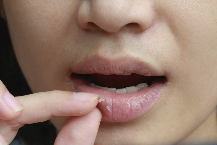 5 dấu hiệu cảnh báo cơ thể thiếu sắt, cần bổ sung ngay - ảnh 3