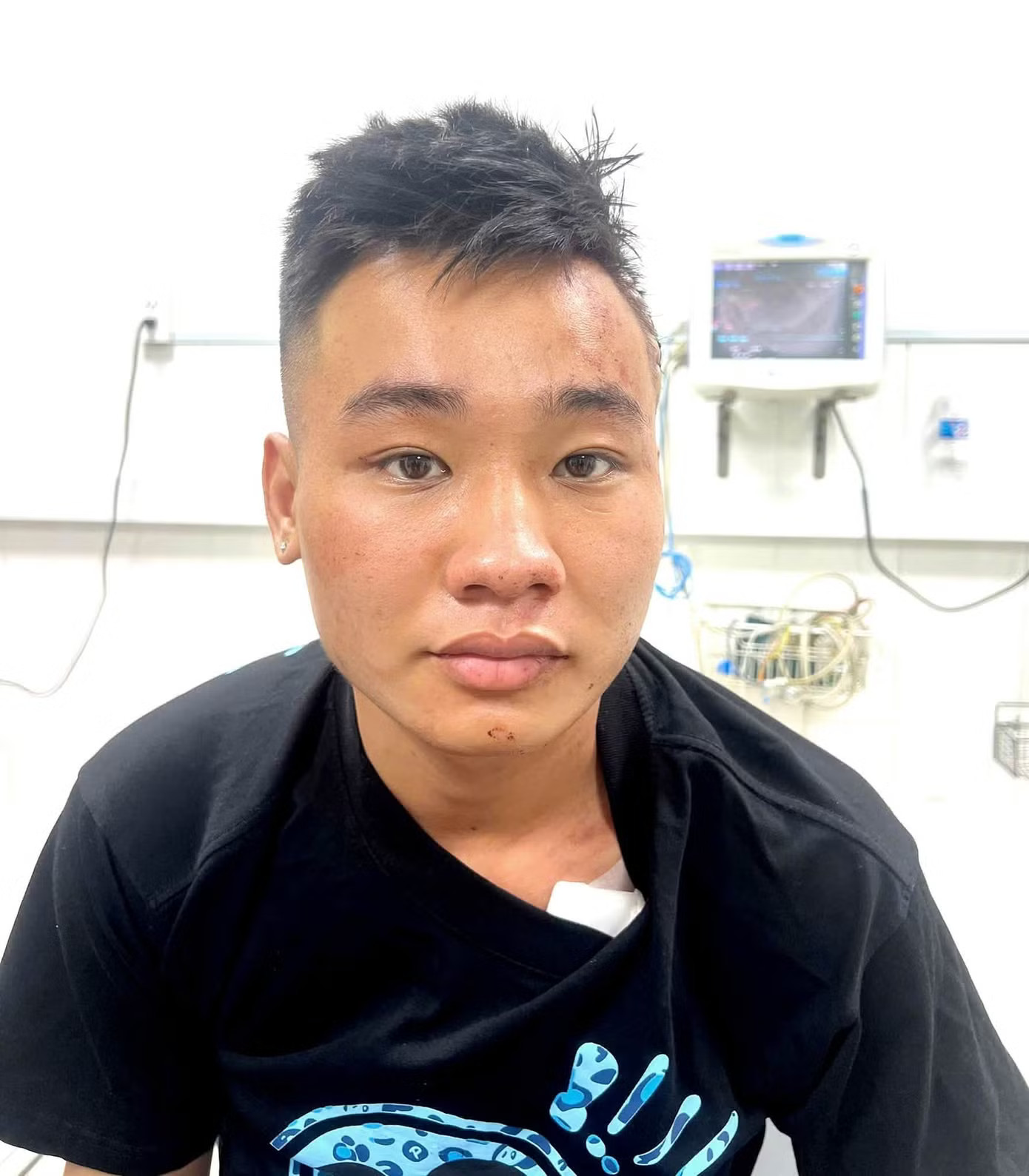 Nghi phạm Nguyễn Đức Anh đang được điều trị tại cơ sở y tế do bị thương. Lời khai của nghi phạm gây ra vụ thảm án ở Đồng Nai - Ảnh 1.